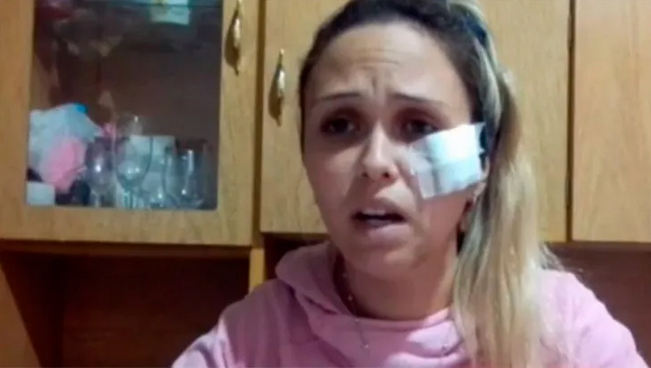 Su ex pareja la arrastró con el auto y la abandonó en medio de la calle: “Mi hija gritaba que yo estaba muerta”