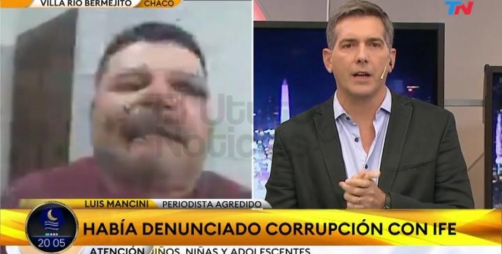 Brutal ataque de sicarios a un periodista radial de V. Rio Bermejito