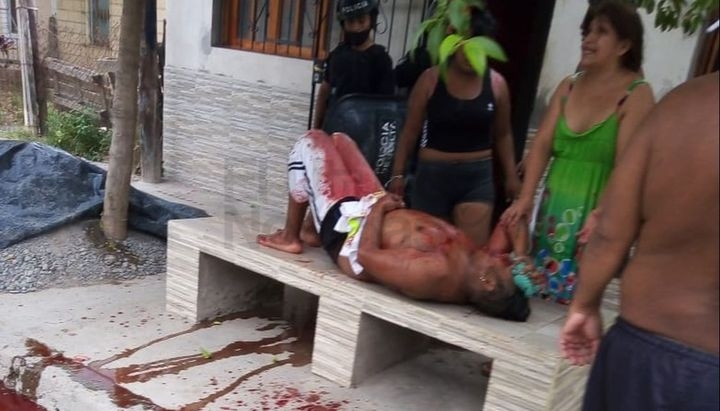 Tras una discusión en la vía pública, un hombre fue apuñalado