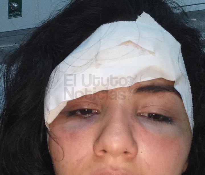 La Justicia investiga un feroz ataque que sufriera una mujer en Mosconi.